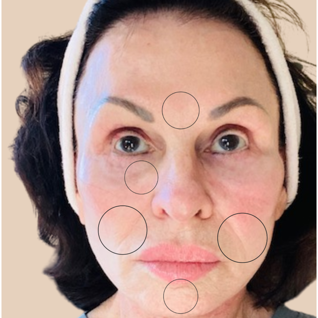 Woman with facial features circled on a beige background